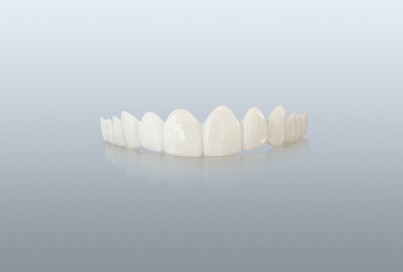 Ultra Thin Single Arch Veneer